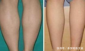 瘦身方案_瘦身建議及方法_瘦身方案減肥產(chǎn)品