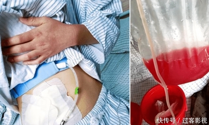 女孩|19岁女孩患尿毒症，被亲妈拉黑，亲爸留下1000元：你多保重