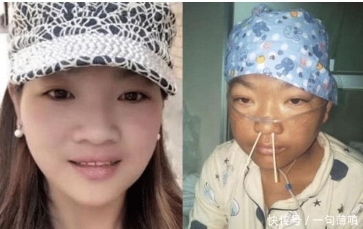 小波|“村花”嫁给穷小伙, 不幸患病“毁容”后对方的做法令人落泪