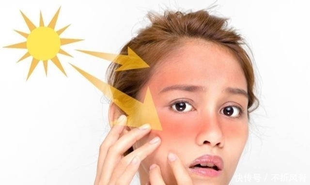皮肤|涂了防晒就完事？晒后修复更重要，三招教你如何“拯救”晒后肌肤