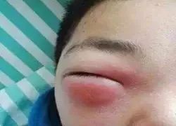  暴雨|头皮发麻！暴雨过后，多处出现小飞虫！