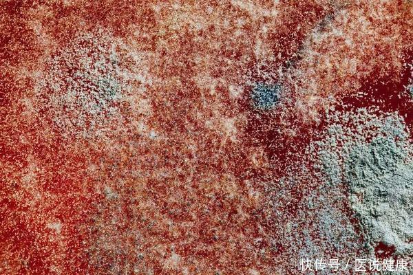 赶紧|警惕藏在厨房里的“致癌物”,高温都杀不死,看完赶紧扔掉