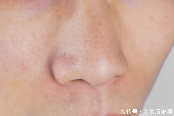 生病|肺生病了，手和脸会出现“怪像”，如果你一个不占，肺还健康