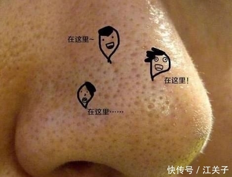 婴儿|鼻子上挤出“白色条状物”？坚持做到这3点，还你光滑“婴儿鼻”！