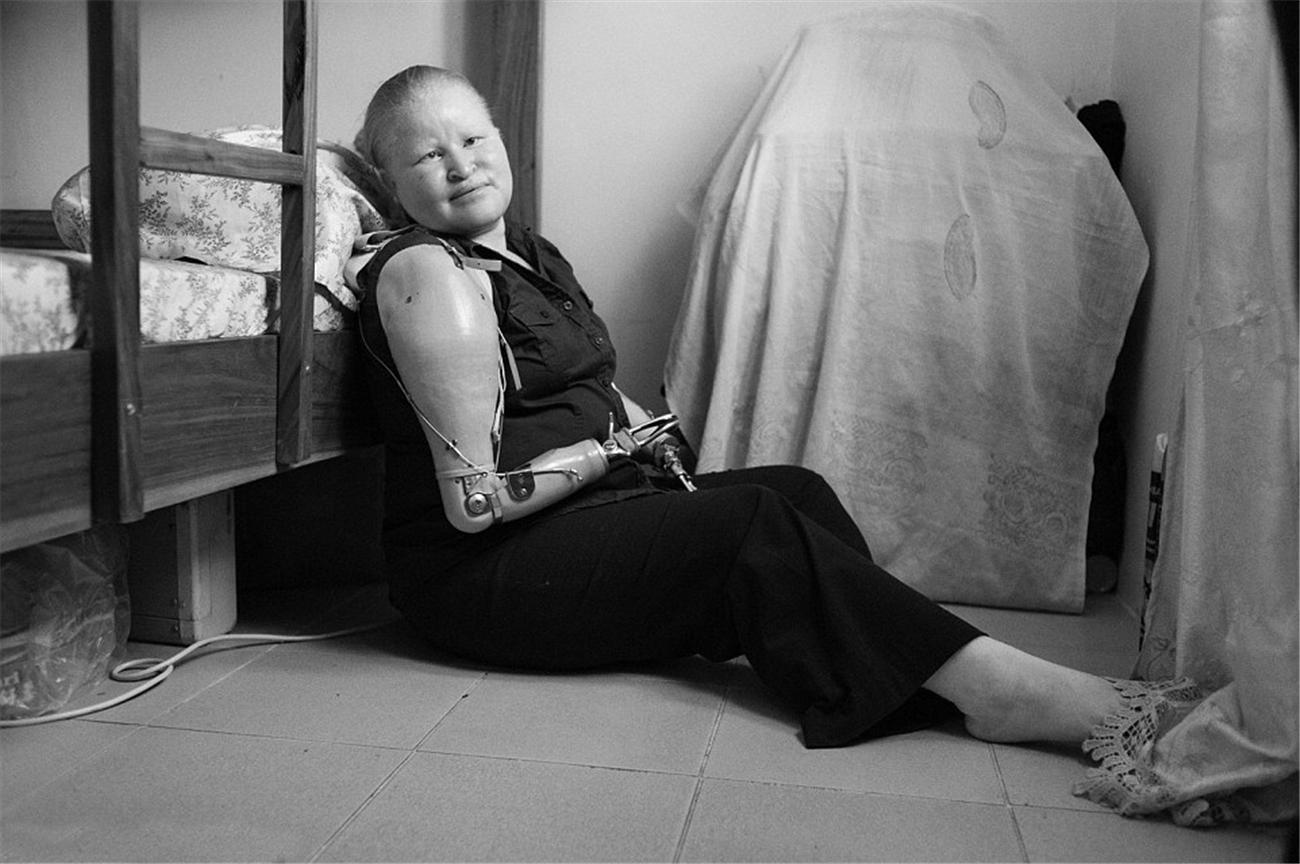 堪比|非洲最“精贵”的人,血液堪比黄金,不少人为他们的身体铤而走险