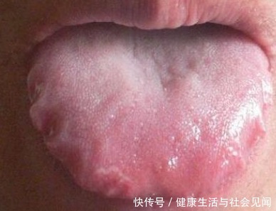 蛋蛋姐|你的身体有没有气虚、血虚、瘀血、寒气、湿气?