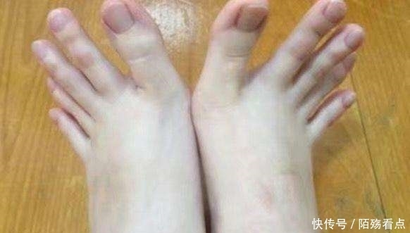 技师|女子做足疗,脱鞋后大家蒙了,技师:按脚十年从来没遇到过