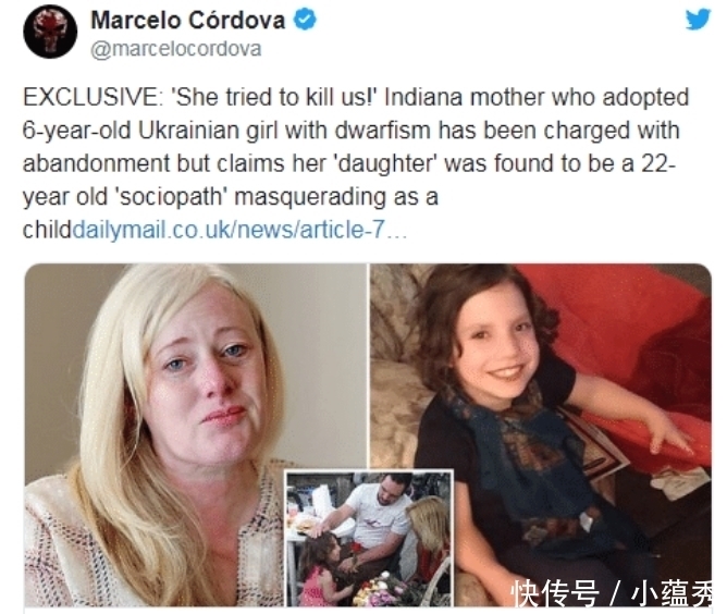 现实|现实版孤儿怨?成年侏儒女假扮6岁女童,只为谋杀养父母