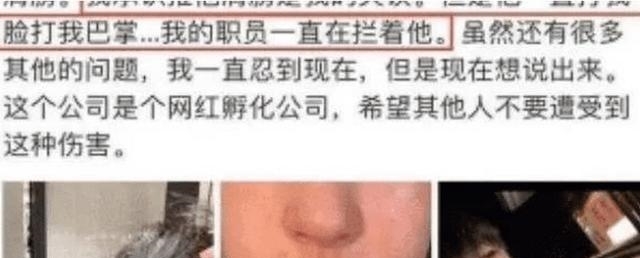  潘南奎|整容成Anglebaby，坑富豪男友600万整容4年，如今大红大紫