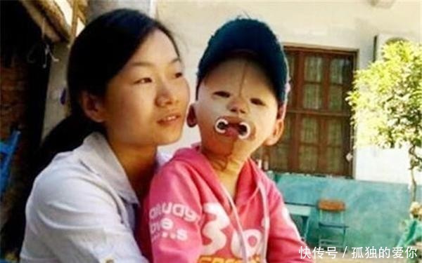 受尽|女孩一直戴头套上学,却受尽同学嘲讽,摘下头套后众人都沉默了