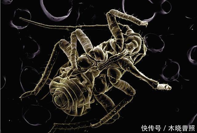  专家|疫情尚未平息，消失20年的传染病在美重出江湖，专家称或早已扩散