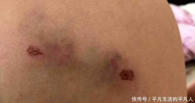  相依为命|哈士奇扑向小孩连续咬伤4人！主人就站在一旁，狗主人：这条狗跟我相依为命