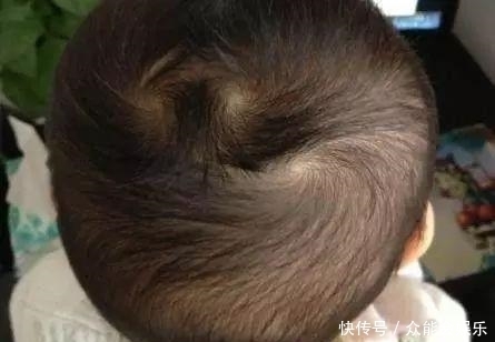 孩子头上的旋的个数代表什么你知道吗?