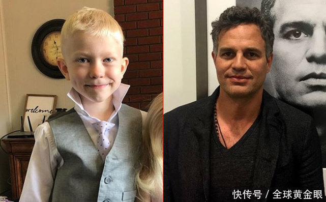  依旧|美6岁男孩为保护妹妹与恶狗搏斗，缝90针笑容依旧，获“绿巨人”盛赞