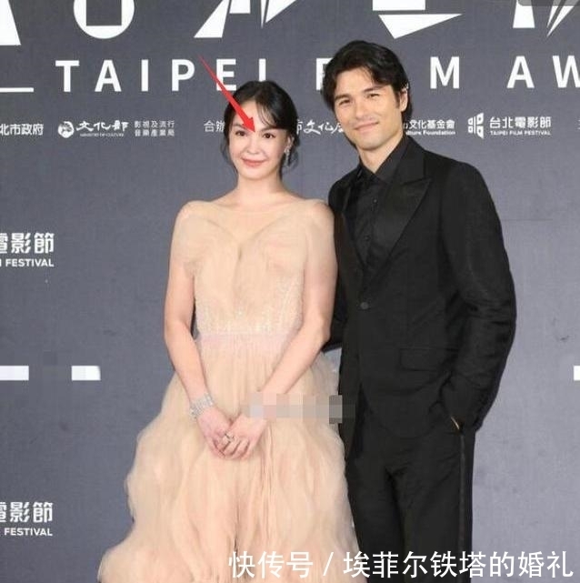 鼻子歪|张榕容填充失败,脸部浮肿法令纹深陷,杨贵妃美貌不再