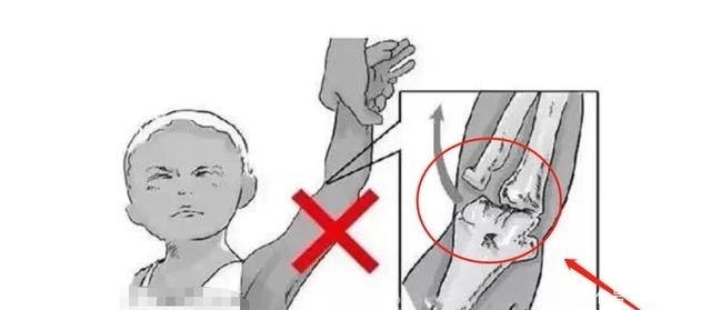  胳膊|父母热衷于牵着宝宝学走路，反而“费力不讨好”，娃受伤都不知道