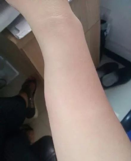  暴雨|头皮发麻！暴雨过后，多处出现小飞虫！