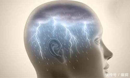 癫痫患者|癫痫病到底能不能治好